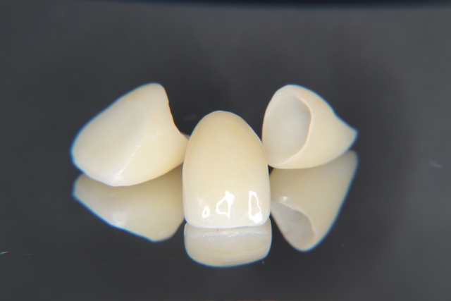 オールセラミック